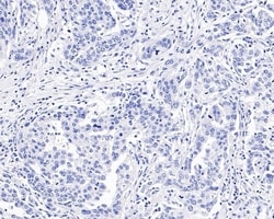 Invitrogen Chromogranin A Recombinant Mouse Monoclonal Antibody (PD01-39)