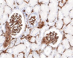 Invitrogen CD34 Recombinant Mouse Monoclonal Antibody (PDM0-12) 100 &mu;L;