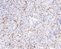 Invitrogen CD68 Recombinant Mouse Monoclonal Antibody (PDM0-13) 100 &mu;L;