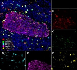 Invitrogen CD68 Recombinant Mouse Monoclonal Antibody (PDM0-13) 100 &mu;L;