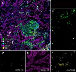 Invitrogen CD68 Recombinant Mouse Monoclonal Antibody (PDM0-13) 100 &mu;L;