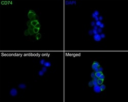 Invitrogen CD74 Recombinant Mouse Monoclonal Antibody (PDM0-22) 100 &mu;L;