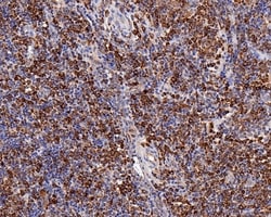 Invitrogen CD74 Recombinant Mouse Monoclonal Antibody (PDM0-22) 100 &mu;L;