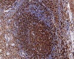 Invitrogen CD74 Recombinant Mouse Monoclonal Antibody (PDM0-22) 100 &mu;L;