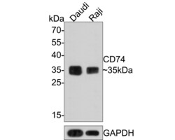 Invitrogen CD74 Recombinant Mouse Monoclonal Antibody (PDM0-22) 100 &mu;L;