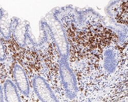 Invitrogen CD79a Recombinant Mouse Monoclonal Antibody (PDM0-23) 100 &mu;L;
