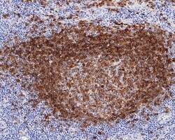 Invitrogen CD79a Recombinant Mouse Monoclonal Antibody (PDM0-23) 100 &mu;L;