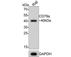 Invitrogen CD79a Recombinant Mouse Monoclonal Antibody (PDM0-23) 100 &mu;L;