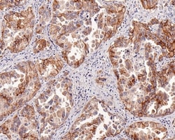 Invitrogen c-Met Recombinant Mouse Monoclonal Antibody (A9A4-R) 100 &mu;L;