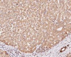 Invitrogen TMED9 Recombinant Mouse Monoclonal Antibody (A9A7-R) 100 &mu;L;