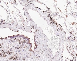 Invitrogen TMED9 Recombinant Mouse Monoclonal Antibody (A9A7-R) 100 &mu;L;