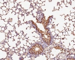 Invitrogen TMED9 Recombinant Mouse Monoclonal Antibody (A9A7-R) 100 &mu;L;