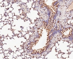 Invitrogen TMED9 Recombinant Mouse Monoclonal Antibody (A9A7-R) 100 &mu;L;