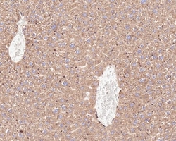 Invitrogen TMED9 Recombinant Mouse Monoclonal Antibody (A9A7-R) 100 &mu;L;