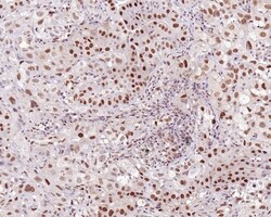 Invitrogen UBA3 Recombinant Mouse Monoclonal Antibody (1B5-2-3-R) 100 &mu;L;