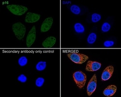 Invitrogen p16INK4a Recombinant Mouse Monoclonal Antibody (PD01-16) 100
