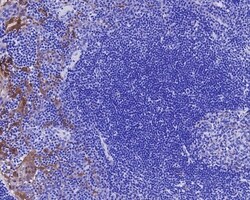 Invitrogen p16INK4a Recombinant Mouse Monoclonal Antibody (PD01-16) 100