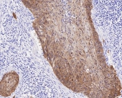 Invitrogen p16INK4a Recombinant Mouse Monoclonal Antibody (PD01-16) 100