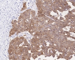 Invitrogen p16INK4a Recombinant Mouse Monoclonal Antibody (PD01-16) 100