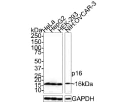 Invitrogen p16INK4a Recombinant Mouse Monoclonal Antibody (PD01-16) 100