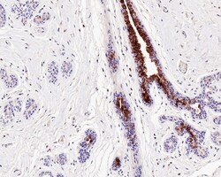 Invitrogen Mammaglobin A Recombinant Mouse Monoclonal Antibody (A9A2-R)