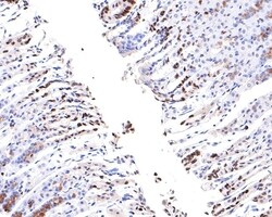 MCM6 Recombinant Rabbit Monoclonal Antibody (JE65-68), Invitrogen 100 &mu;L;