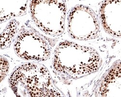 MCM6 Recombinant Rabbit Monoclonal Antibody (JE65-68), Invitrogen 100 &mu;L;
