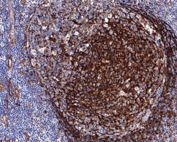 Invitrogen MYO1B Recombinant Rabbit Monoclonal Antibody (JE65-01) 100 &mu;L;