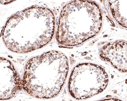 Invitrogen MYO1B Recombinant Rabbit Monoclonal Antibody (JE65-01) 100 &mu;L;