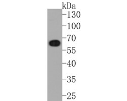 Invitrogen CoA Synthase Recombinant Rabbit Monoclonal Antibody (JE58-56)
