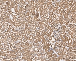 Invitrogen GAPDH Recombinant Rabbit Monoclonal Antibody (PD00-07) 100 &mu;L | Buy Online | Invitrogen&trade; | Fisher Scientific