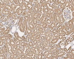 Invitrogen GAPDH Recombinant Rabbit Monoclonal Antibody (PD00-07) 100 &mu;L | Buy Online | Invitrogen&trade; | Fisher Scientific