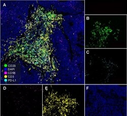 Invitrogen CD20 Recombinant Rabbit Monoclonal Antibody (PD00-02) 100 &mu;L;