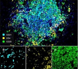 Invitrogen CD20 Recombinant Rabbit Monoclonal Antibody (PD00-02) 100 &mu;L;