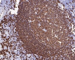 Invitrogen CD20 Recombinant Rabbit Monoclonal Antibody (PD00-02) 100 &mu;L;