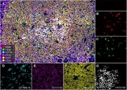 Invitrogen CD20 Recombinant Rabbit Monoclonal Antibody (PD00-02) 100 &mu;L;