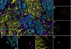 Invitrogen CD20 Recombinant Rabbit Monoclonal Antibody (PD00-02) 100 &mu;L;