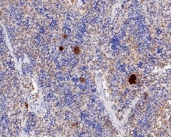 Invitrogen TGF beta-1 Recombinant Rabbit Monoclonal Antibody (PD00-17)