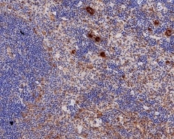 Invitrogen TGF beta-1 Recombinant Rabbit Monoclonal Antibody (PD00-17)