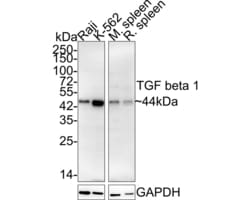 Invitrogen TGF beta-1 Recombinant Rabbit Monoclonal Antibody (PD00-17)