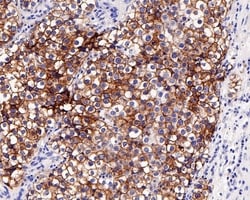 Invitrogen c-Kit Recombinant Rabbit Monoclonal Antibody (PD00-24) 100 &mu;L;