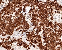Invitrogen c-Kit Recombinant Rabbit Monoclonal Antibody (PD00-24) 100 &mu;L;