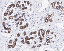 Invitrogen c-Kit Recombinant Rabbit Monoclonal Antibody (PD00-24) 100 &mu;L;