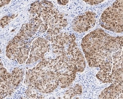 Invitrogen SOX2 Recombinant Rabbit Monoclonal Antibody (PO00-28) 100 &mu;L;