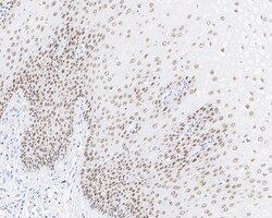 Invitrogen SOX2 Recombinant Rabbit Monoclonal Antibody (PO00-28) 100 &mu;L;
