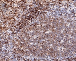 Invitrogen CD22 Recombinant Rabbit Monoclonal Antibody (PO00-31) 100 &mu;L;