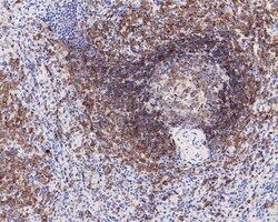 Invitrogen CD22 Recombinant Rabbit Monoclonal Antibody (PO00-31) 100 &mu;L;