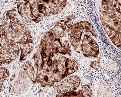Invitrogen UPK3A Recombinant Rabbit Monoclonal Antibody (PD00-09) 100 &mu;L;