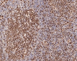 Invitrogen PU.1 Recombinant Rabbit Monoclonal Antibody (PD00-14) 100 &mu;L | Buy Online | Invitrogen&trade; | Fisher Scientific