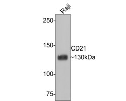 Invitrogen CD21 Recombinant Rabbit Monoclonal Antibody (PD00-23) 100 &mu;L;